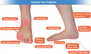 Foot Pain